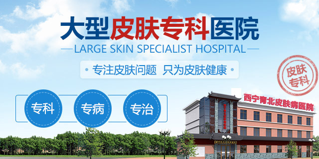 西宁治疗皮肤病医院